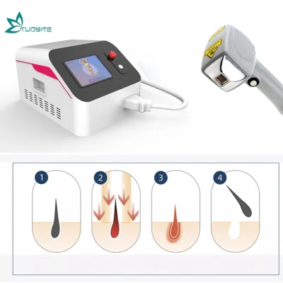 Tragbare Pikosekunden-Lasermaschine zur Tattoo-Entfernung, geschaltetes Carbon-Laser-Schälgerät